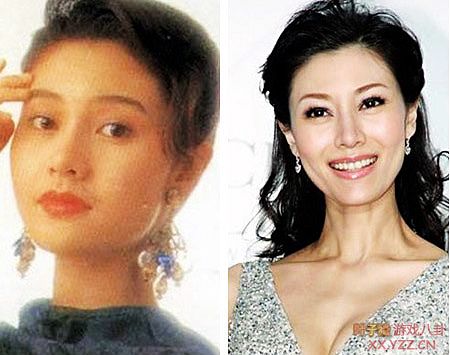 娱乐圈女明星大饼脸惊变锥子